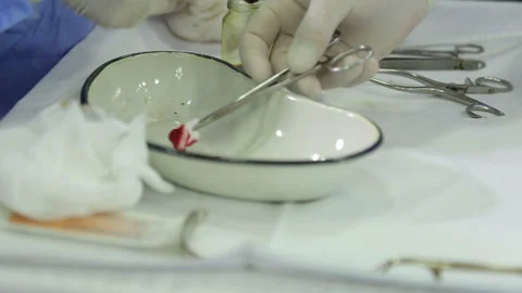 Team surgeon at work in operating room. Modern equipment in operating room. Stock Footage 168535077