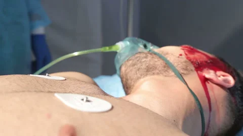 Team surgeon at work in operating room. Stock Footage 168536153