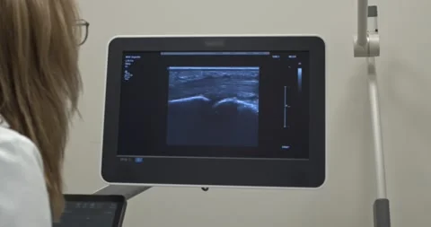 Team surgeon at work in operating room. Modern equipment in operating room Stock Footage 203914600