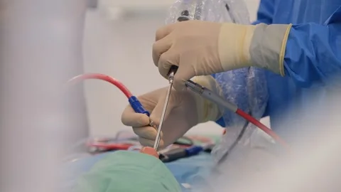 Team Of Surgeons And Assistants Performing Surgery In Hospital Operating Room Stock Footage