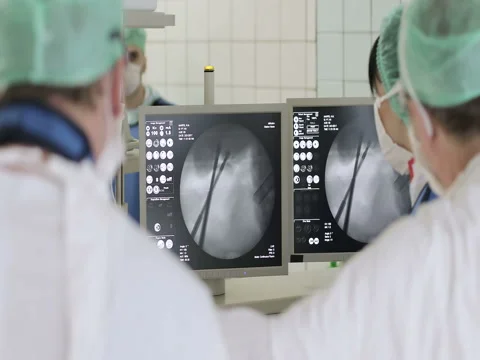 The team of surgeons controls the operation on the displays. Stock Footage 73891135
