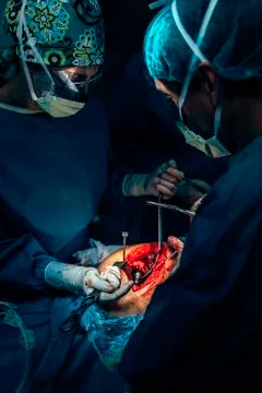 Team of Surgeons Operating. Stock Photos