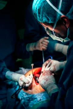 Team of Surgeons Operating. Stock Photos