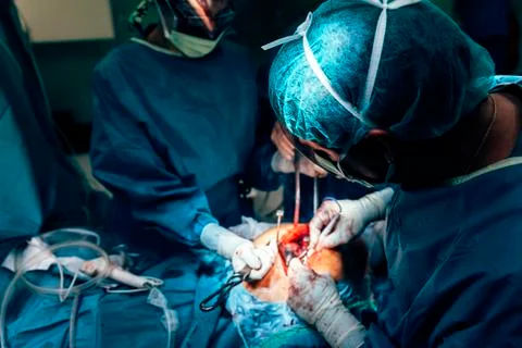 Team of Surgeons Operating. Stock Photos