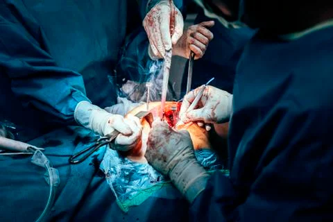 Team of Surgeons Operating. Stock Photos