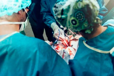 Team of Surgeons Operating. Stock Photos