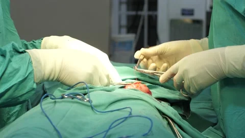 Team of surgeons in operating theater performing operation on a patient . Stock Footage 156017334