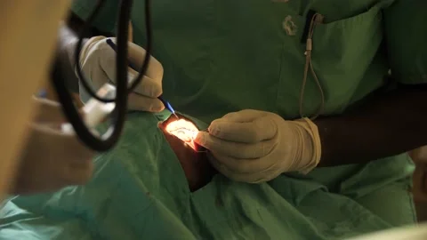 Team of surgeons in operating theater performing operation on a patient . Stock Footage 165430234