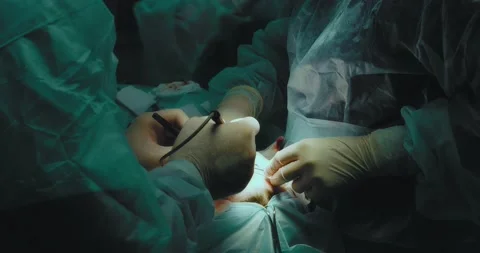 Team of surgeons perform blepharoplasty surgery. Stock Footage 199601007