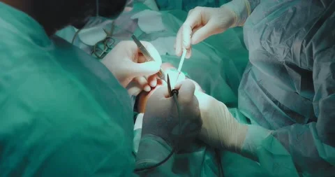 Team of surgeons perform blepharoplasty surgery. Stock Footage 199601104