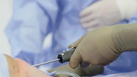 A team of surgeons at work in the operating room. Stockbeeldmateriaal 269445815