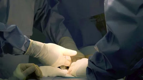 A team of surgeons at work in the operating room. Stock Footage 270462410