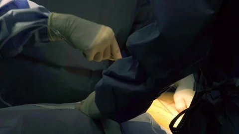 A team of surgeons at work in the operating room. Stock Footage 270467261