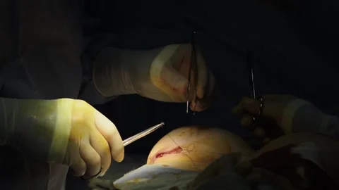 A team of surgeons at work in the operating room Stockbeeldmateriaal 270547138