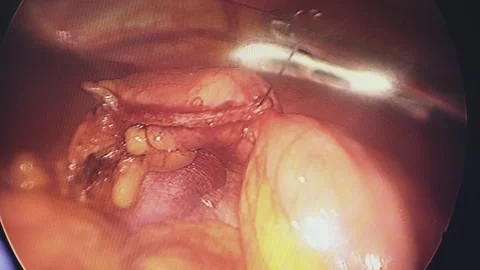 A team of surgeons at work in the operating room Stockbeeldmateriaal 270549616