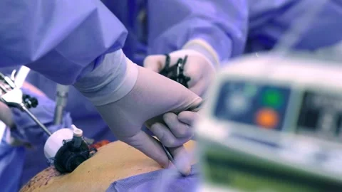 A team of surgeons at work in the operating room Stockbeeldmateriaal 270551091