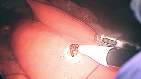 A team of surgeons at work in the operating room Stockbeeldmateriaal 270552725