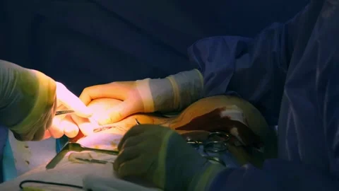 A team of surgeons at work in the operating room Stockbeeldmateriaal 270555145