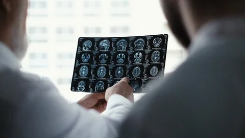 Team of three doctors discuss X-ray of patient in consulting room of hospital Stock Footage 125016107