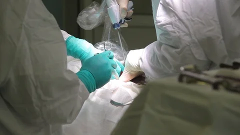 A team of two surgeons performs an oncological operation using nanotechnology Stock Footage 94022259