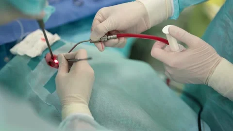 Teams of skilled surgeons performing the operating procedure on the patient Vídeo Stock 179829364