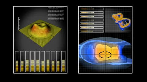 Technical Instruments Stock Footage 26146233