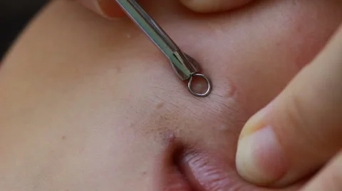 Technical squeeze acne by tool. Stock Footage 51689197