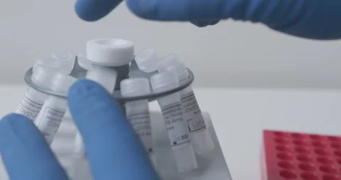 Technician loads the samples with the sample into the laboratory centrifuge 스톡 동영상 149678090