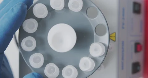 Technician loads the samples with the sample into the laboratory centrifuge Vídeo Stock 149678601