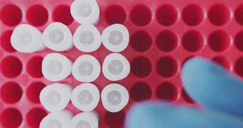 Technician loads the samples together with the sample into the lab stand Stock Footage 149679728