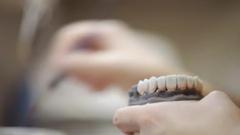 The technician models a ceramic dental crown Video stock 147226547