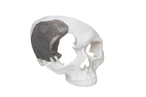 Technological concept featuring white skull with metallic implant, contrast.. Stock Photos