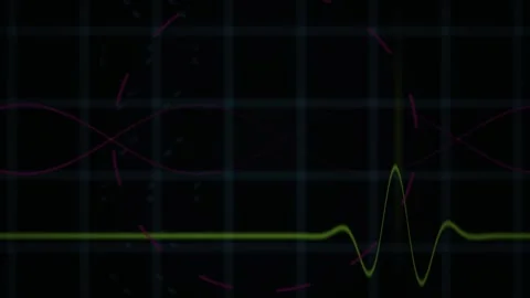 Technology waveform graph on screen. Stock Footage 340041634