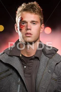 Teenage boy with facial injuries Stock Photos