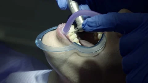 Teeth alignment in the clinic Stock Footage 149192971