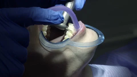 Teeth alignment in the clinic Video stock 149192975