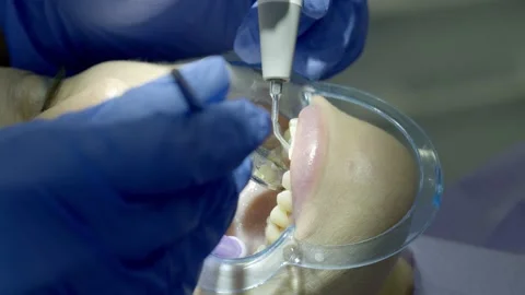 Teeth alignment in the clinic Stock Footage 149192994