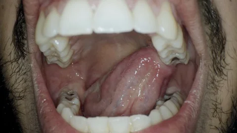 Teeth and tongue close up Stock-Footage 107221606