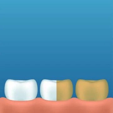 Teeth on blue Stock Illustration