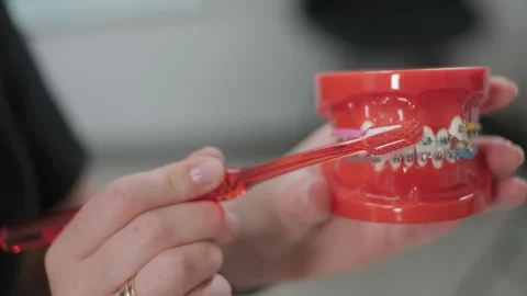 Teeth with brace cleaning explanation, brush your teeth with a toothbrush Stock Footage 250352974