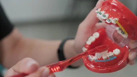Teeth with brace cleaning explanation, brush your teeth with a toothbrush Stock Footage 251020981
