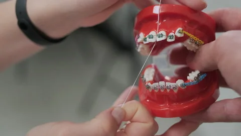 Teeth with brace cleaning explanation, brush your teeth with a toothbrush Stock Footage 251021159