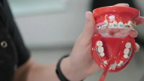 Teeth with brace cleaning explanation, brush your teeth with a toothbrush Stock Footage 252019507