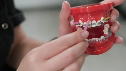 Teeth with brace cleaning explanation, brush your teeth with a toothbrush  Stock Footage 252019780