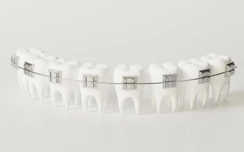 Teeth brace in the white background, 3d rendering. Stock Illustration