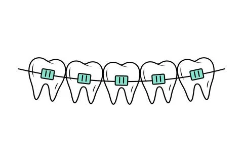Teeth with braces in doodle style. Corrective Orthodontics. Dental care. Li.. Stock Illustration