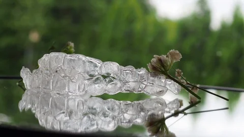 Teeth braces in glass Invisible brackets slew in glass surface Stock-Footage 113353923