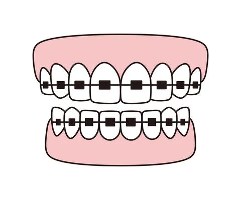 Teeth braces icons, Vector flat illustration Stock-Illustration