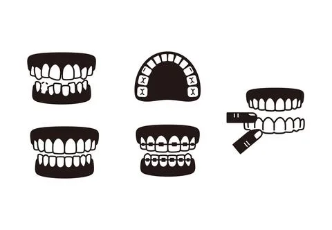 Teeth braces icons, Vector flat illustration Stock Illustration