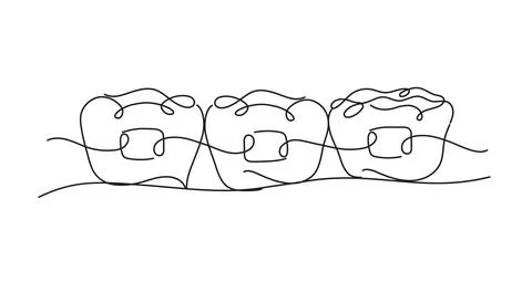 Teeth braces illustration flat line white color 스톡 일러스트